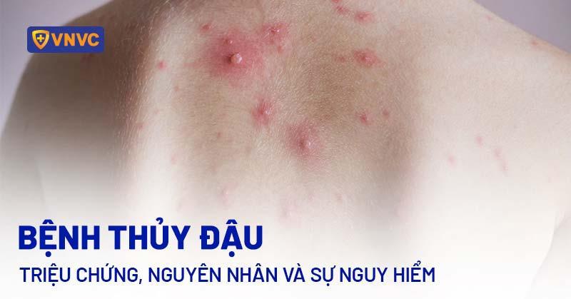 Hình ảnh một đàn chó con sơ sinh đang nằm bú mẹ hoặc ngủ cùng nhau, thể hiện kết quả của một thai kỳ khỏe mạnh và minh họa số lượng con trong một lứa đẻ.